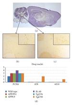 Phospho-Tau (Ser202, Thr205) Antibody in Immunohistochemistry (IHC)
