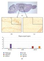 Phospho-Tau (Ser202, Thr205) Antibody in Immunohistochemistry (IHC)