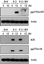 Phospho-p27 Kip1 (Thr187) Antibody in Western Blot (WB)