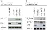 Hepatitis C Virus Core Antigen Antibody in Western Blot (WB)