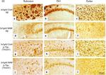 Phospho-Tau (Thr231) Antibody in Immunohistochemistry (IHC)