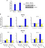 Estrogen Receptor beta Antibody in Western Blot (WB)