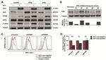 Hepatitis C Virus Core Antigen Antibody in Western Blot (WB)