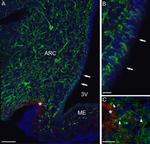 GnRH1 Antibody in Immunohistochemistry, Immunocytochemistry (IHC, ICC/IF)