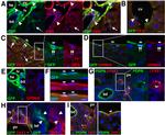 Podoplanin Antibody in Immunohistochemistry, Immunocytochemistry (IHC, ICC/IF)