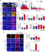 Phospho-FAK (Tyr397) Antibody in Immunohistochemistry, Immunocytochemistry (IHC, ICC/IF)