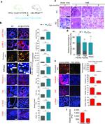 Phospho-FAK (Tyr397) Antibody in Immunohistochemistry, Immunocytochemistry (IHC, ICC/IF)