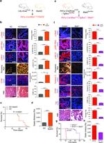 Phospho-FAK (Tyr397) Antibody in Immunohistochemistry, Immunocytochemistry (IHC, ICC/IF)