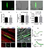 GFP Antibody in Immunohistochemistry, Immunocytochemistry (IHC, ICC/IF)