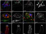 GFP Antibody in Immunohistochemistry, Immunocytochemistry (IHC, ICC/IF)