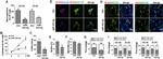 Ki-67 Antibody in Immunocytochemistry (ICC/IF)