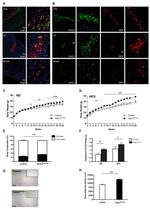 GFP Antibody in Immunohistochemistry, Immunocytochemistry (IHC, ICC/IF)