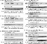 Phospho-SRC (Tyr419) Antibody in Western Blot (WB)
