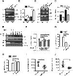 Hepatitis C Virus Core Antigen Antibody in Western Blot (WB)
