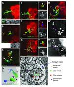 GFP Antibody in Immunohistochemistry, Immunocytochemistry (IHC, ICC/IF)