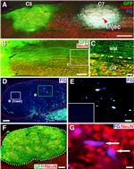 GFP Antibody in Immunohistochemistry, Immunocytochemistry (IHC, ICC/IF)