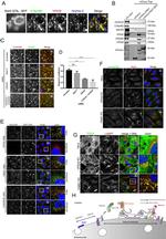 C16orf62 Antibody in Immunohistochemistry, Immunocytochemistry (IHC, ICC/IF)