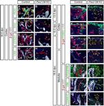 CD140b (PDGFRB) Antibody in Immunocytochemistry (ICC/IF)