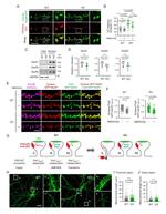 GFP Antibody in Immunohistochemistry (Paraffin), Immunocytochemistry (IHC (P), ICC/IF)