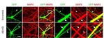 MAP2 Antibody in Immunocytochemistry (ICC/IF)
