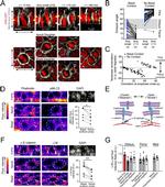alpha Catenin Antibody in Immunohistochemistry, Immunocytochemistry (IHC, ICC/IF)