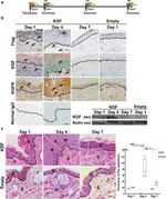FGFR2 Antibody in Immunohistochemistry (IHC)
