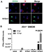 IFIT2 Antibody in Immunocytochemistry (ICC/IF)