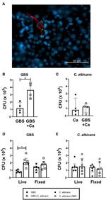 Candida albicans Antibody in Immunohistochemistry, Immunocytochemistry (IHC, ICC/IF)