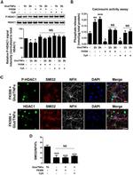 HDAC1 Antibody in Western Blot, Immunohistochemistry, Immunocytochemistry (WB, IHC, ICC/IF)