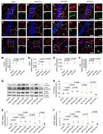 Ki-67 Antibody in Immunohistochemistry, Immunocytochemistry (IHC, ICC/IF)