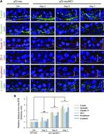 beta Catenin Antibody in Immunohistochemistry (IHC)