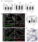 FOXJ1 Antibody in Immunohistochemistry (IHC)