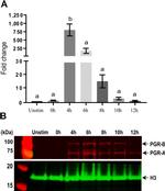 Progesterone Receptor Antibody in Western Blot (WB)