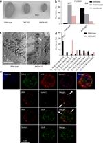 SLC25A31 Antibody in Immunohistochemistry, Immunocytochemistry (IHC, ICC/IF)