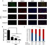 AIF Antibody in Immunohistochemistry, Immunocytochemistry (IHC, ICC/IF)