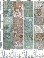 GSDMD Antibody in Immunohistochemistry (IHC)