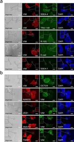 E-cadherin Antibody in Immunohistochemistry, Immunocytochemistry (IHC, ICC/IF)