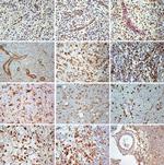 SEL1L Antibody in Immunohistochemistry (IHC)