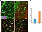 ARX Antibody in Immunohistochemistry, Immunocytochemistry (IHC, ICC/IF)