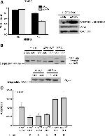 XPA Antibody in Western Blot (WB)