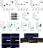 IFN alpha Monoclonal Antibody (RMMA-1)
