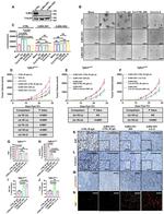 CD3e Antibody in Immunohistochemistry (IHC)