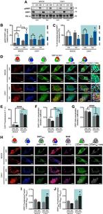 HSPA9 Antibody in Immunocytochemistry (ICC/IF)