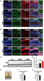 FTO Antibody in Western Blot, Immunohistochemistry, Immunocytochemistry (WB, IHC, ICC/IF)