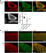 Destrin Antibody in Immunocytochemistry (ICC/IF)