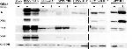 Dengue Virus Type 2 NS1 Antibody in Western Blot (WB)
