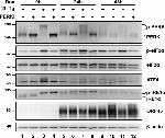 KSHV ORF45 Antibody in Western Blot (WB)