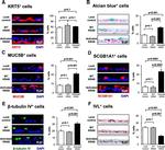 Cytokeratin 5 Antibody in Immunohistochemistry, Immunocytochemistry (IHC, ICC/IF)