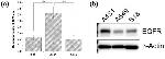 EGFR Antibody in Western Blot (WB)