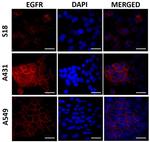 EGFR Antibody in Immunocytochemistry (ICC/IF)